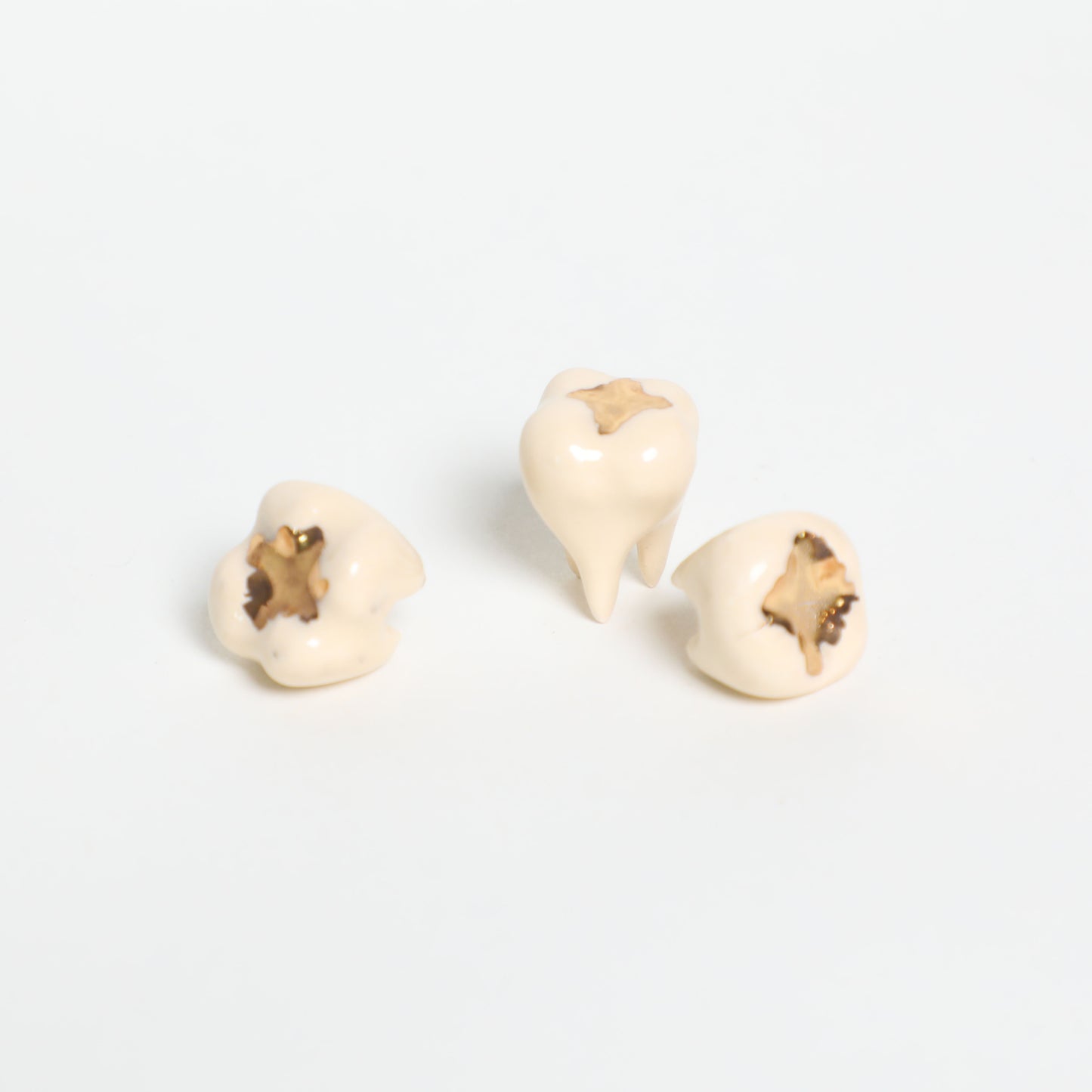 Magic Molar in Gold Filling