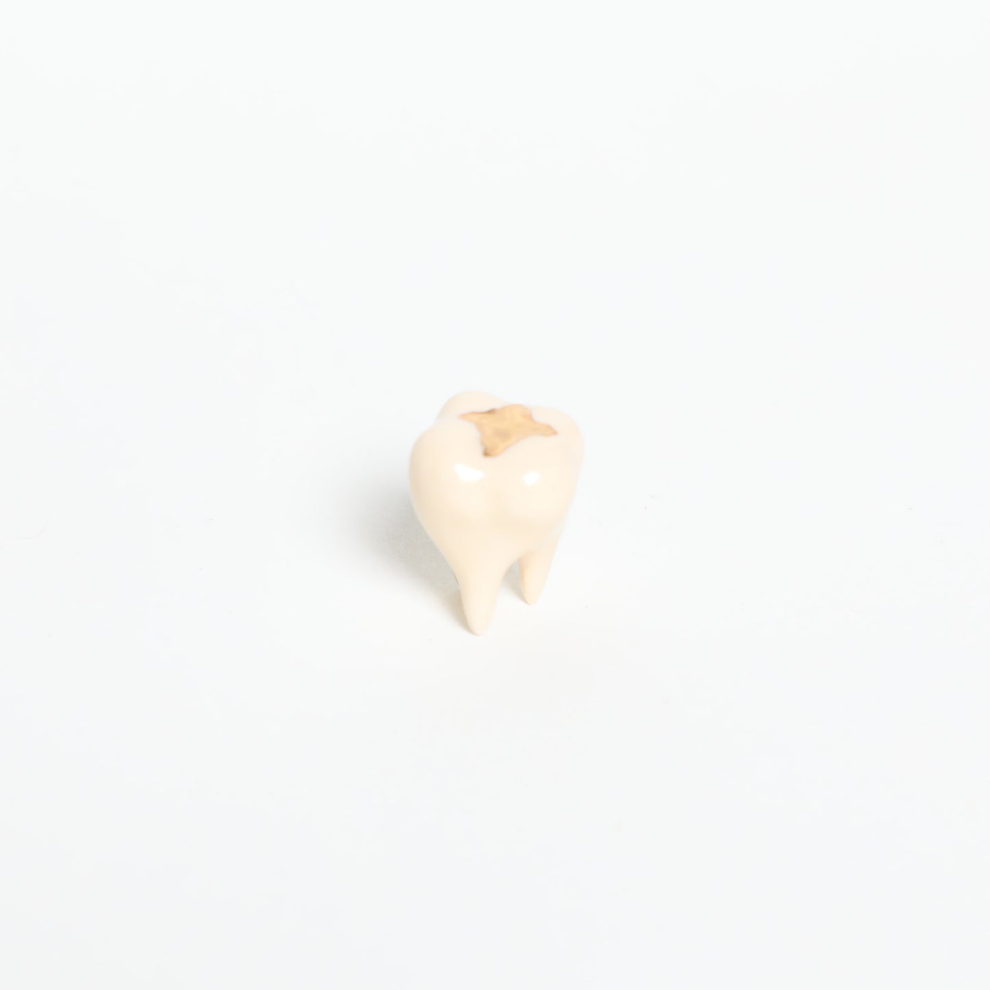 Magic Molar in Gold Filling